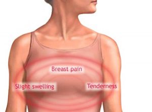 Top 10,Warning Signs,Breast Cancer,Symptoms