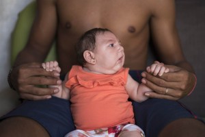 Virus,Zika Virus,Microcephaly,America