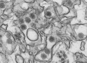 Virus,Zika Virus,Microcephaly,America